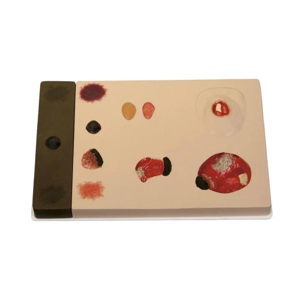 Simulador de Curación Avanzada de Heridas - Modelo de Clasificación de Lesiones por Presión Pat